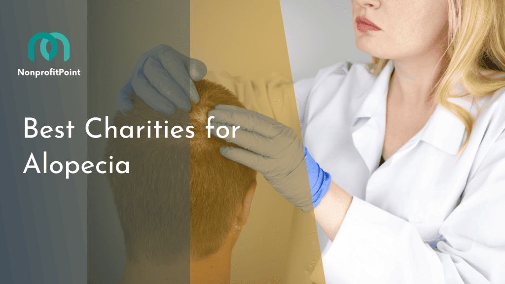 Best Charities for Alopecia