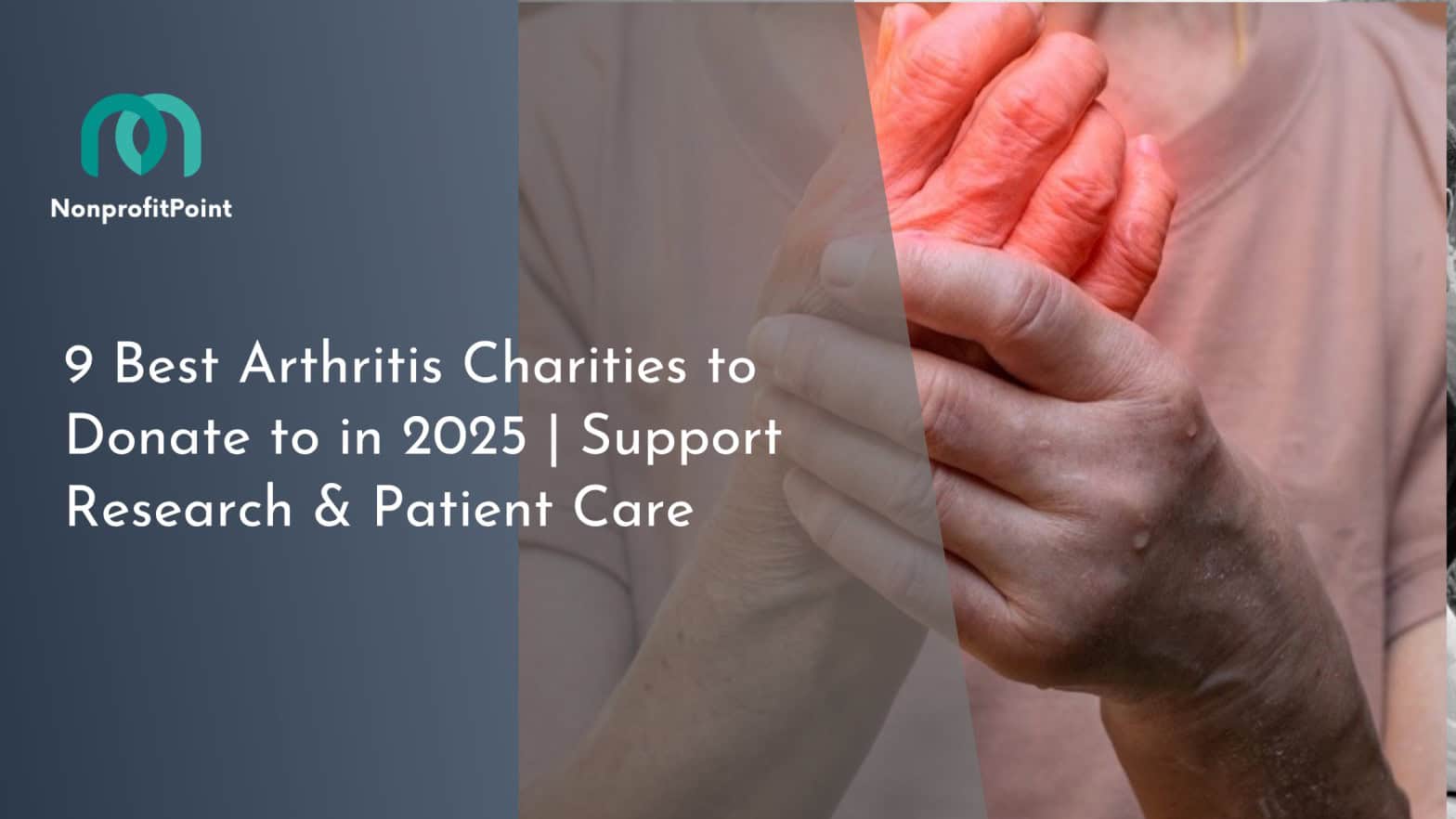 Hand pain, arthritis